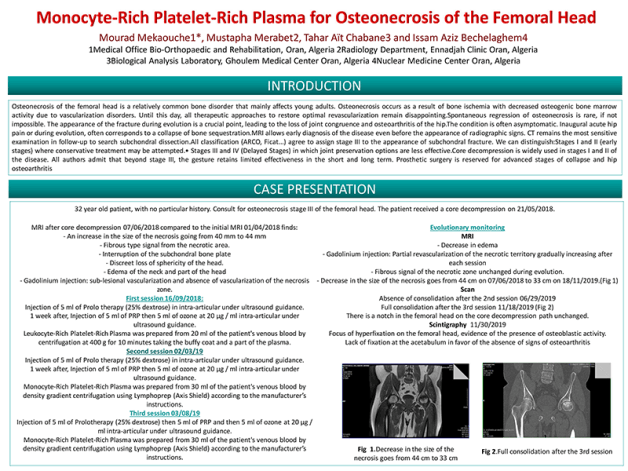 Monocyte Rich Platelet Rich Plasma for Osteonecrosis of the Femoral Head