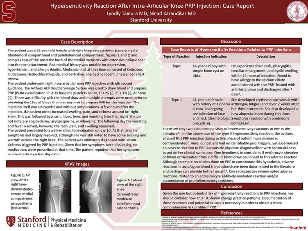 Hypersensitivity Reaction After Intra-Articular Knee PRP Injection: Case Report